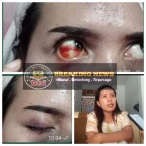 Pengeroyokan Oknum Istri Kades Sukosari Kecamatan Jatiroto, Kasus Masih Dalam Proses Penyelidikan
